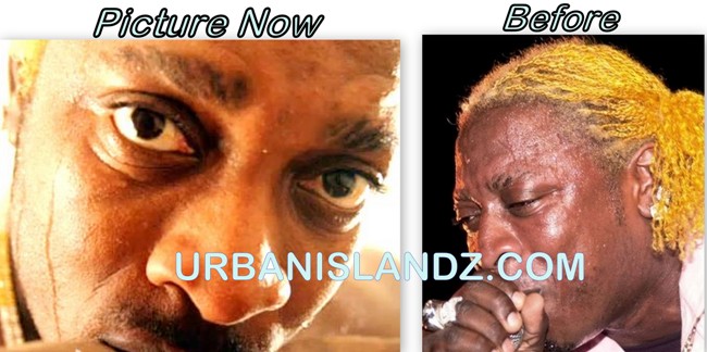 Kartel discusses the cake soap he claims he falsely uses to bleach his skin!
