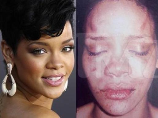 rihanna assault image