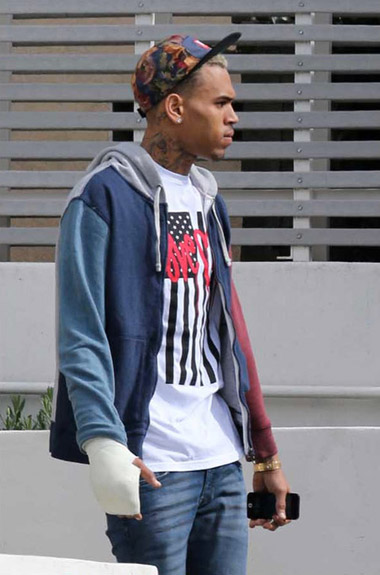 chris brown injury hand cast