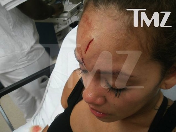 Evelyn Lozada assault photo