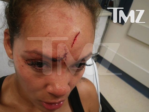 Evelyn Lozada forehead assault photo