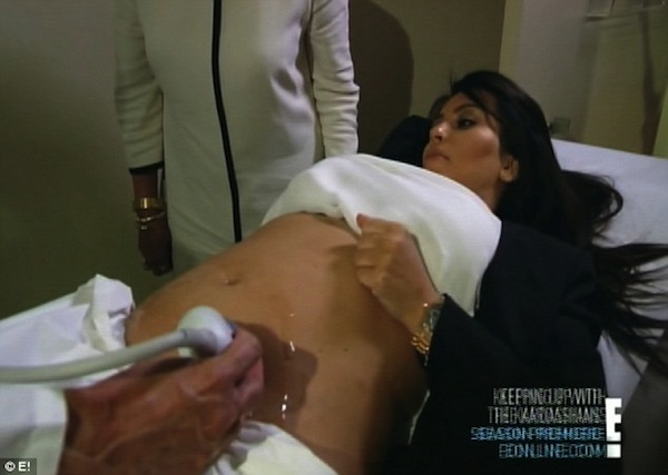 Kim Kardashian in labor