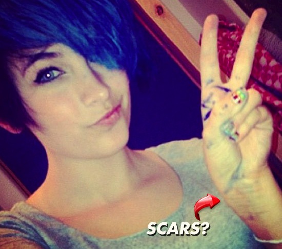 Paris Jackson wrist scars