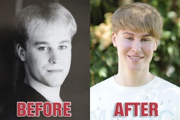 Toby Sheldon before and after