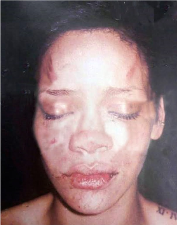 Rihanna battered face