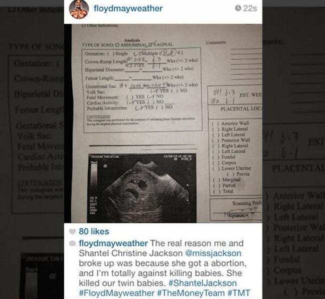 Floyd Mayweather Shantel Jackson aboration doc