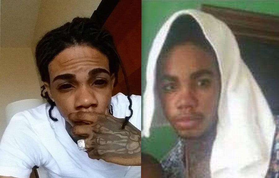 Did Alkaline Removed Eyeball Tattoo Or Was It Contacts ?