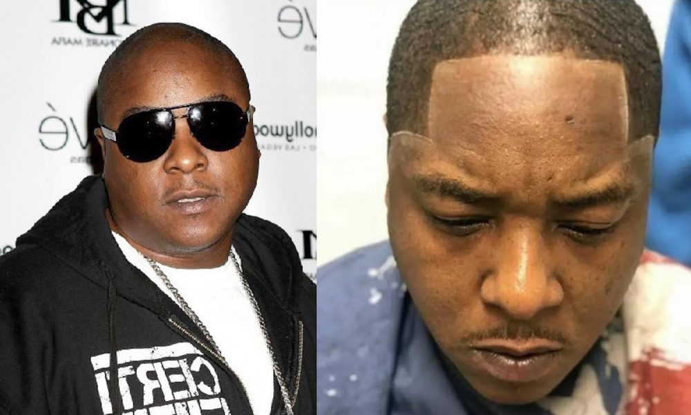 Jadakiss hairline