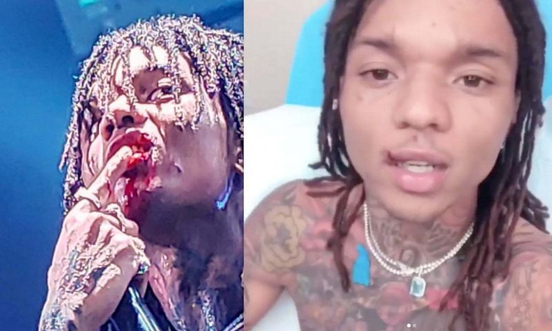 Swae Lee busted lip