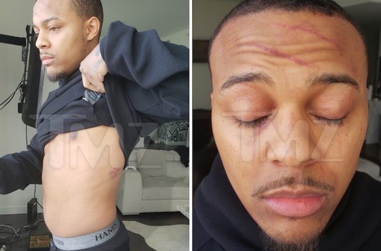 Bow Wow injuries