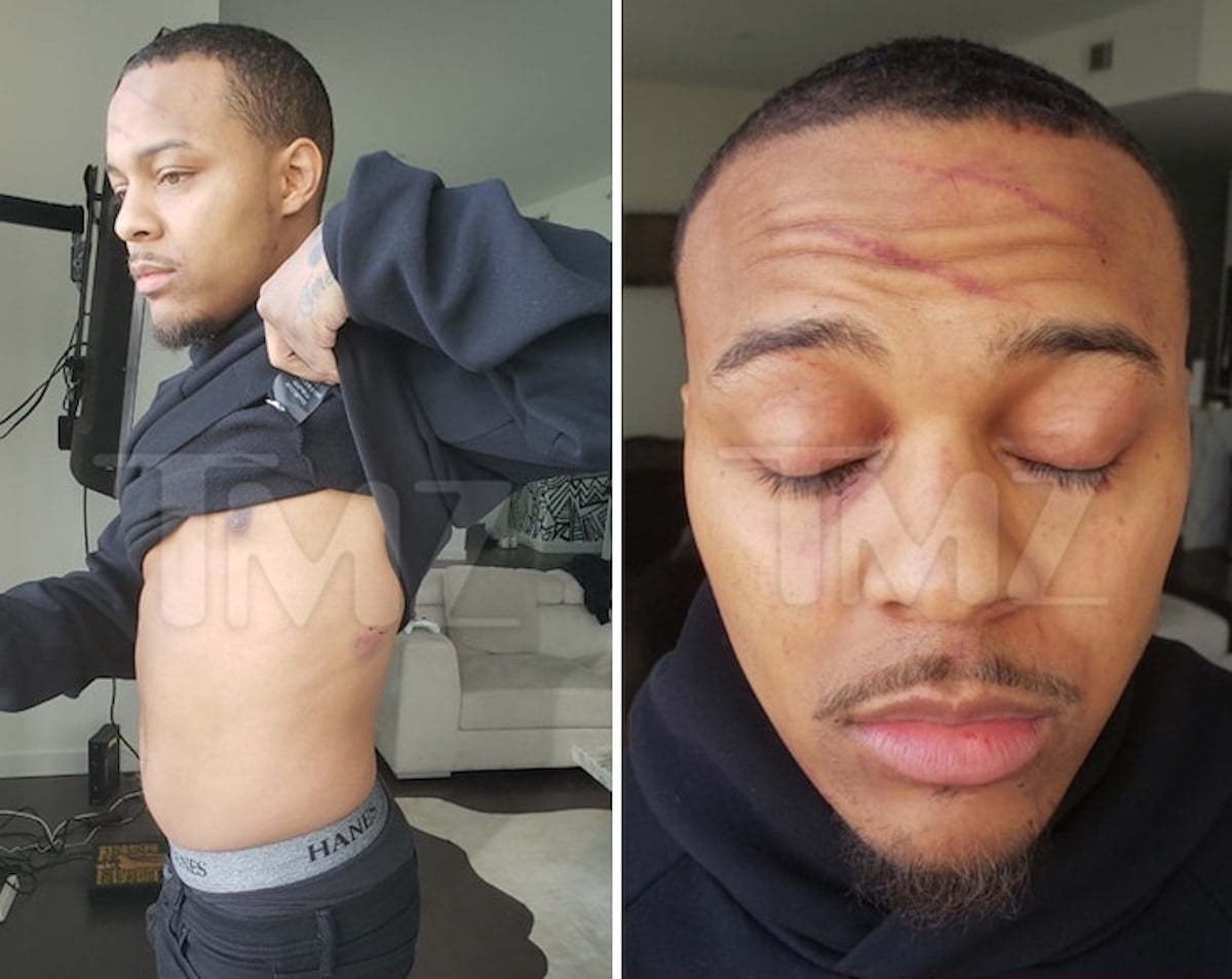 Bow Wow injuries
