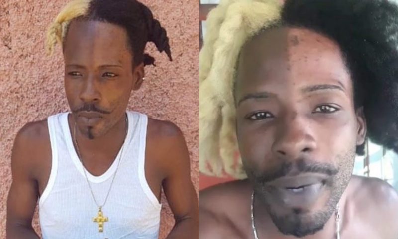 Dancehall artiste SKP bleach face