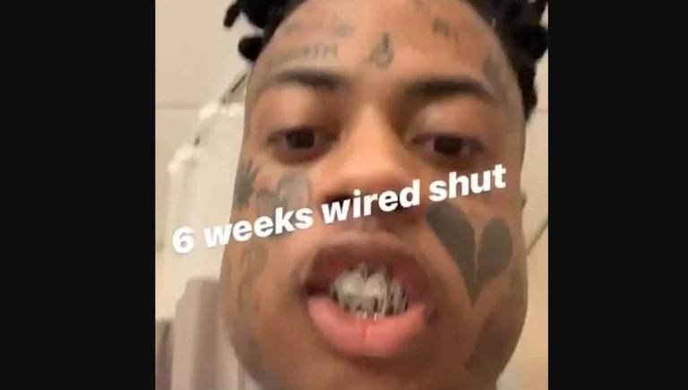 Rapper Boonk Gang Broken Jaw Wired Shut For Six Weeks Unable To Talk Urban Islandz 